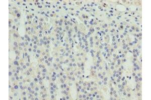 Immunohistochemistry of paraffin-embedded human adrenal gland tissue using ABIN7176155 at dilution of 1:100 (ZNF215 antibody  (AA 12-304))