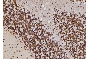 ABIN6274428 at 1/100 staining Rat brain tissue by IHC-P. (HIPK4 antibody  (C-Term))