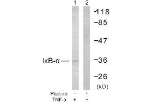 Western Blotting (WB) image for anti-Nuclear Factor of kappa Light Polypeptide Gene Enhancer in B-Cells Inhibitor, alpha (NFKBIA) (Ser32), (Ser36) antibody (ABIN1848117) (NFKBIA antibody  (Ser32, Ser36))