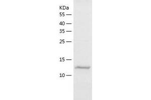 Western Blotting (WB) image for Selectin L (SELL) (AA 190-332) protein (His tag) (ABIN7285538) (L-Selectin Protein (AA 190-332) (His tag))