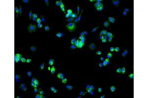 Immunofluorescence analysis of MCF-7 cells using SLC2A1 antibody (ABIN5997113).