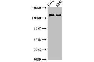 Western Blot Positive WB detected in: Hela whole cell lysate, K562 whole cell lysate All lanes: EEA1 antibody at 3 μg/mL Secondary Goat polyclonal to rabbit IgG at 1/50000 dilution Predicted band size: 163 kDa Observed band size: 163 kDa (EEA1 antibody  (AA 734-875))