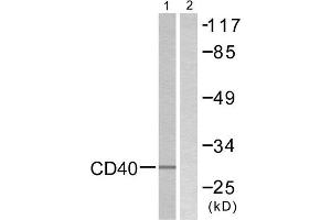Western Blotting (WB) image for anti-CD40 (CD40) (C-Term) antibody (ABIN1848817) (CD40 antibody  (C-Term))