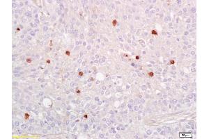 Immunohistochemistry (IHC) image for anti-Nuclear Factor-kB p65 (NFkBP65) (pSer536) antibody (ABIN730528)