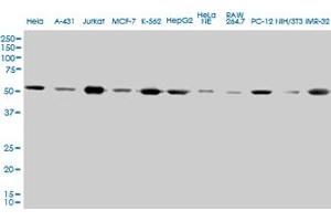 TUBA1 monoclonal antibody (M01), clone 2E11. (TUBA4A antibody  (AA 1-448))