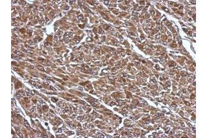 IHC-P Image Immunohistochemical analysis of paraffin-embedded U87 xenograft, using RABGGTB, antibody at 1:500 dilution. (RABGGTB antibody)