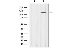 anti-Leucine-Rich PPR-Motif Containing (LRPPRC) (Internal Region) antibody