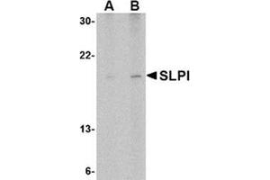 Image no. 1 for anti-Secretory Leukocyte Peptidase Inhibitor (SLPI) (Middle Region) antibody (ABIN318889) (SLPI antibody  (Middle Region))