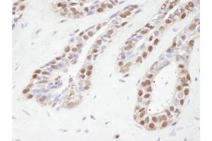 anti-Transducin (Beta)-Like 1 X-Linked Receptor 1 (TBL1XR1) (AA 100-150) antibody