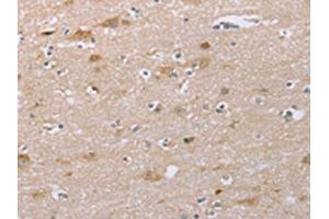 The image on the left is immunohistochemistry of paraffin-embedded Human brain tissue using ABIN7192262(SAMD9L Antibody) at dilution 1/30, on the right is treated with synthetic peptide. (SAMD9L antibody)