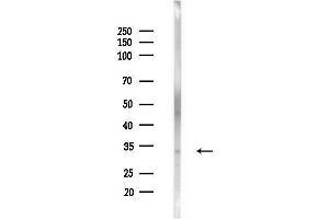 anti-Homeobox A11 (HOXA11) antibody