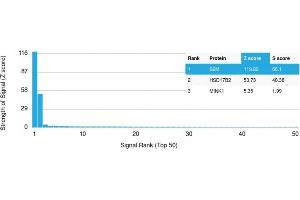 Protein Array (PAr) image for anti-beta-2-Microglobulin (B2M) antibody (ABIN6940416)