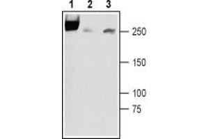 Western blot analysis of rat newborn brain lysates (lanes 1 and 3), rat adult brain membranes (lane 2): - 1,2. (SCN3A antibody  (3rd Extracellular Loop, Domain 1))