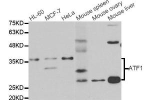 Western blot analysis of extracts of various cell lines, using ATF1 antibody. (AFT1 antibody)