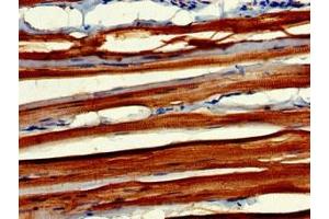 Immunohistochemistry of paraffin-embedded human skeletal muscle tissue using ABIN7160604 at dilution of 1:100 (MYBPC2 antibody  (AA 739-1141))