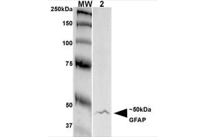 Western Blot analysis of Rat Brain Membrane showing detection of GFAP protein using Mouse Anti-GFAP Monoclonal Antibody, Clone S206A-8 .