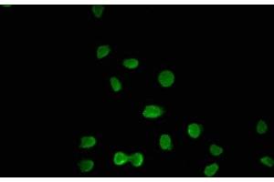 Immunofluorescence staining of A549 cells with ABIN7176586 at 1:100, counter-stained with DAPI. (GLIS3 antibody  (AA 527-663))