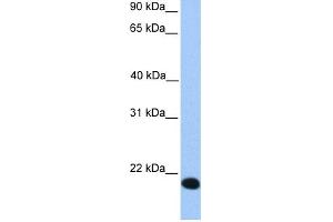 WB Suggested Anti-ZNF833P Antibody Titration:  0. (LOC401898 antibody  (Middle Region))