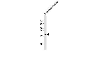 Anti-NACA2 Antibody (N-Term) at 1:2000 dilution + human skeletal muscle lysate Lysates/proteins at 20 μg per lane. (NACA2 antibody  (AA 36-69))