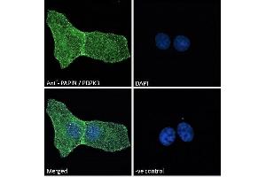 ABIN185158 Immunofluorescence analysis of paraformaldehyde fixed U2OS cells, permeabilized with 0. (PDZD2 antibody  (N-Term))