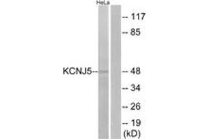Western blot analysis of extracts from HeLa cells, using KCNJ5 Antibody. (KCNJ5 antibody  (AA 370-419))