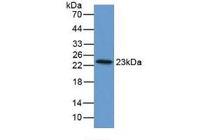 Figure. (FTL antibody  (AA 1-175))