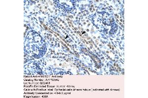 Human kidney (ANKRD11 antibody  (N-Term))