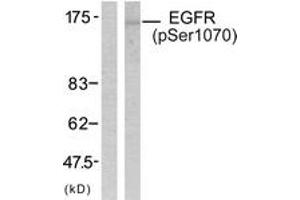 Western blot analysis of extracts from SK-OV3 cells treated with EGF, using EGFR (Phospho-Ser1070) Antibody. (EGFR antibody  (pSer1070))