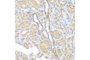 Immunohistochemistry of paraffin-embedded mouse kidney using Sec23AA Rabbit mAb (ABIN7270168) at dilution of 1:100 (40x lens). (SEC23A antibody)