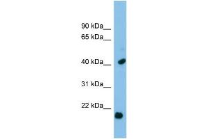 WB Suggested Anti-HSPB2 Antibody Titration: 0. (HSPB2 antibody  (Middle Region))