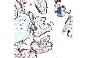 Immunohistochemistry of paraffin-embedded human placenta using  Rabbit mAb (ABIN7265406) at dilution of 1:100 (40x lens). (ATF5 antibody)
