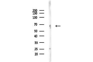 Western blot analysis of lysates from Rat brain, using KCN Antibody at 1/1000 dilution.