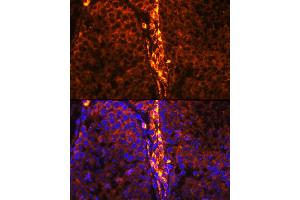 Immunofluorescence analysis of mouse testis using RBP1 Rabbit pAb (ABIN6129597, ABIN6146795, ABIN6146796 and ABIN6214136) at dilution of 1:100 (40x lens). (RBP1 antibody  (AA 63-197))