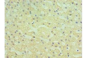 Immunohistochemistry of paraffin-embedded human liver tissue using ABIN7155969 at dilution of 1:100