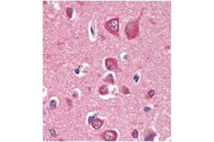 Immunohistochemistry (IHC) image for anti-PTEN Induced Putative Kinase 1 (PINK1) antibody (ABIN356391) (PINK1 antibody)
