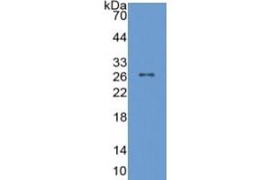 WB of Protein Standard: different control antibodies against Highly purified E. (SLC27A5 ELISA Kit)