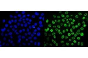 IF analysis of SUMO2/3 using anti-SUMO2/3 antibody (ABIN7600856). (SUMO2/3 antibody  (AA 24-72))