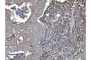 IHC analysis of EHD3 using anti-EHD3 antibody (ABIN7602777). (EHD3 antibody  (C-Term))