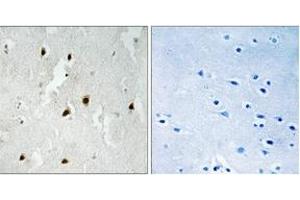 Immunohistochemistry analysis of paraffin-embedded human brain, using FOXO4 (Phospho-Ser262) Antibody. (FOXO4 antibody  (pSer262))