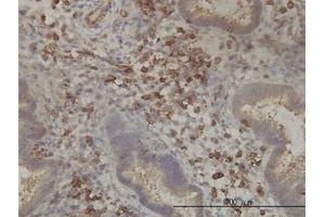 Image no. 1 for anti-Pantothenate Kinase 2 (PANK2) (AA 205-260) antibody (ABIN599308) (PANK2 antibody  (AA 205-260))