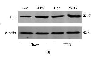 Protein expression of PPARγ, IL-6, and TNF-α in WAT after vibration for 8 weeks. (IL-6 antibody  (AA 111-150))