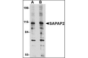 Western blot analysis of SAPAP2 in L1210 cell lysate with this product at (A) 0. (DLGAP2 antibody  (Center))