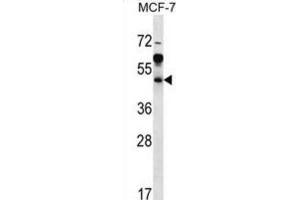 Western Blotting (WB) image for anti-ADP-Ribosylation Factor Interacting Protein 1 (ARFIP1) antibody (ABIN2997067) (ARFIP1 antibody)