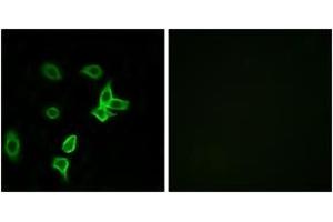 Immunofluorescence analysis of A549 cells, using KANK2 Antibody. (KANK2 antibody  (AA 351-400))