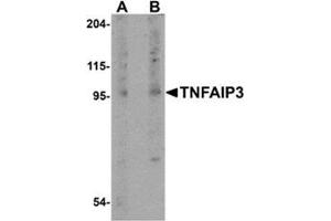 Western blot analysis of TNFAIP3 in rat lung tissue lysate with this product at (A) 1 and (B) 2 μg/ml. (TNFAIP3 antibody  (Center))