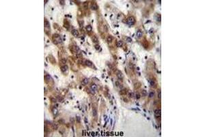 Immunohistochemistry (IHC) image for anti-PHD Finger Protein 20 (PHF20) antibody (ABIN2996558)