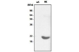 Recombinant crystallin alpha A (alphaA) and the extract of mouse eye (ME) were resolved by SDS-PAGE, transferred to PVDF membrane and probed with anti-human crystallin alpha B antibody (1:1,000). (CRYAB antibody  (AA 1-175))