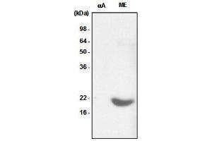 Recombinant crystallin alpha A (alphaA) and the extract of mouse eye (ME) were resolved by SDS-PAGE, transferred to PVDF membrane and probed with anti-human crystallin alpha B antibody (1:1,000). (CRYAB antibody)