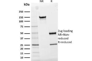 SDS-PAGE Analysis Purified CD25 Mouse Monoclonal Antibody (IL2RA/2395). (CD25 antibody  (AA 42-183))