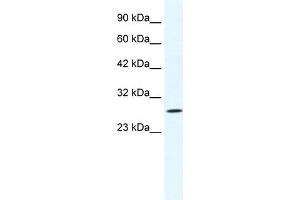 CLIC1 antibody  (N-Term)
